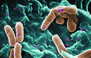 nucleo ocular microbiama pseudomonas