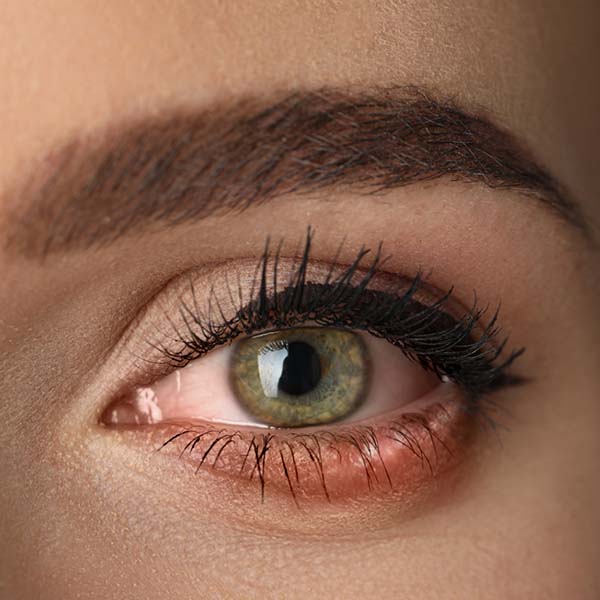 ojo enfermo afectado por la cirugía refractiva